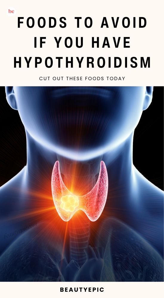 foods to avoid if you have hypothyroidism
