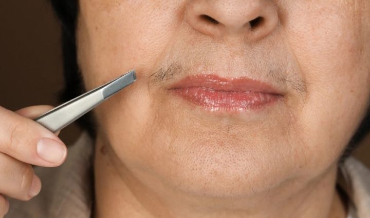 Tweezing — For Small, Stubborn Hairs