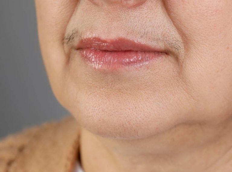 How to Use Honey and Lemon Juice to Remove Facial Hair Naturally