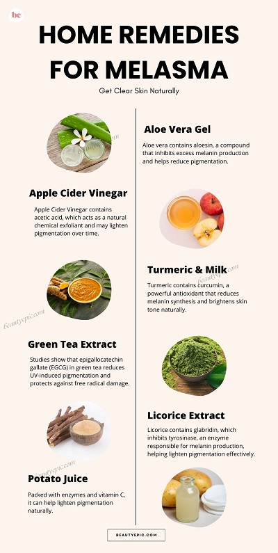 Home Remedies for Melasma