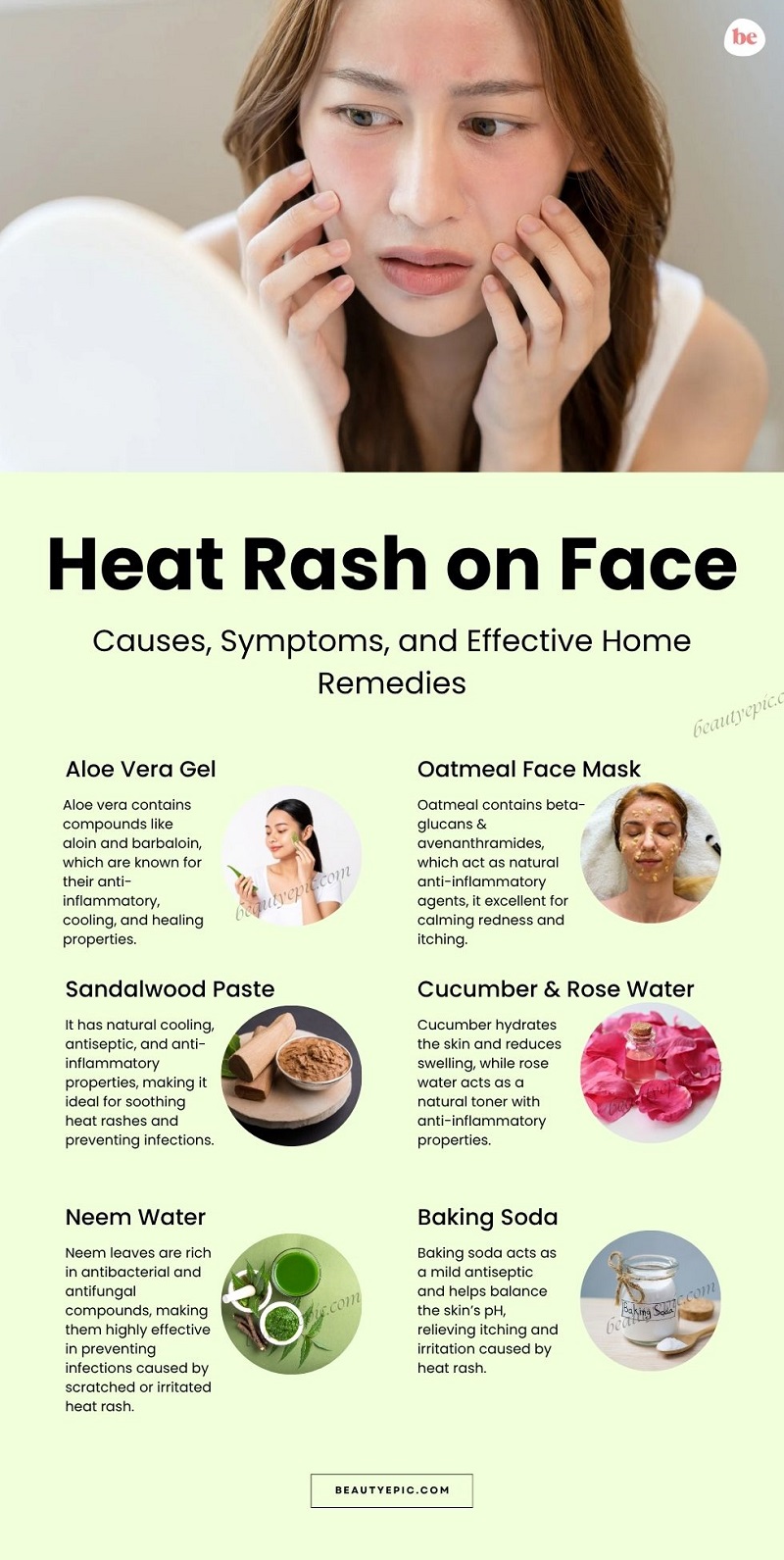 Heat Rash on Face
