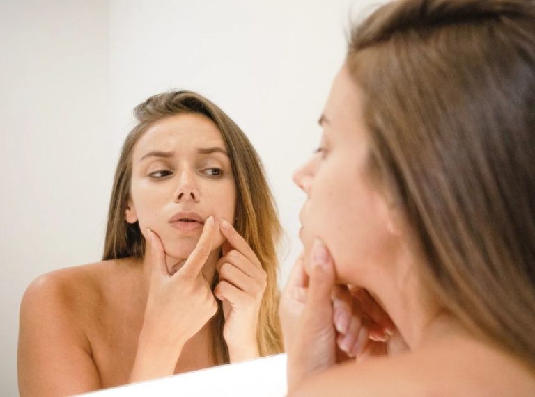 Homemade Face Wash For Acne: Easy Recipes To Try At Home