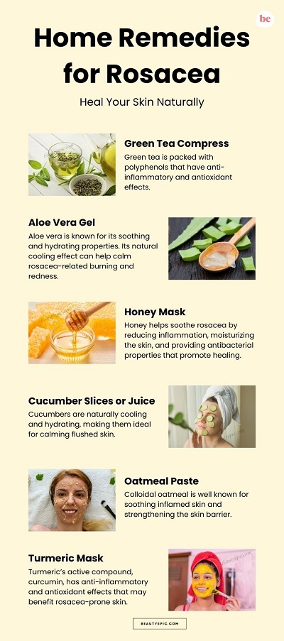 Home Remedies for Rosacea