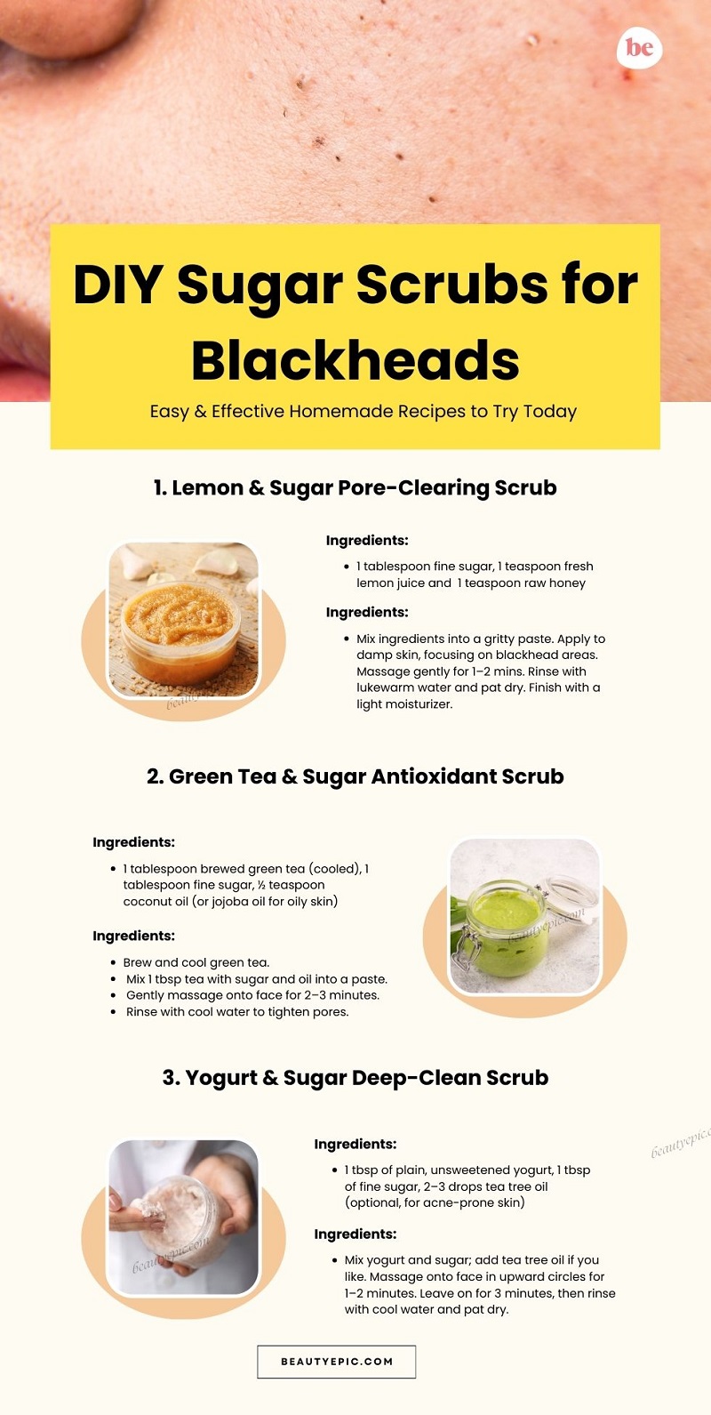DIY Sugar Scrubs for Blackheads