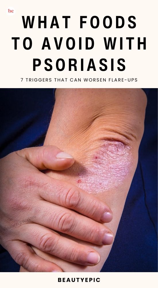 What Foods to Avoid with Psoriasis