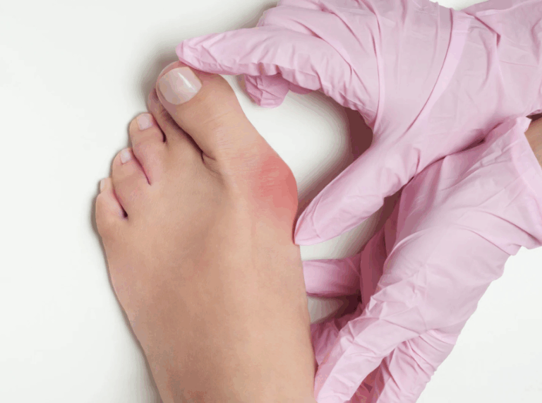 10 Bunion Exercises for Pain Relief and Prevention