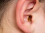 How to Safely Remove Earwax at Home Remedies and What to Avoid