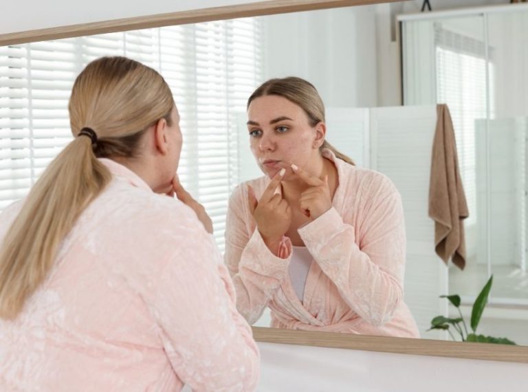 5 Best Herbal Teas to Reduce Hormonal Acne Naturally