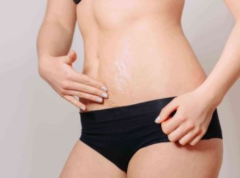 essential oils for stretch marks removal