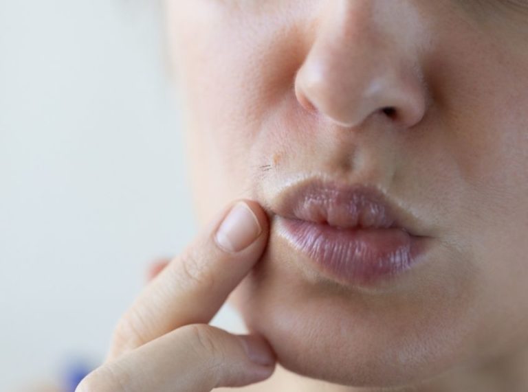 Papaya and Turmeric Remedy for Facial Hair Removal: Natural & Effective Method