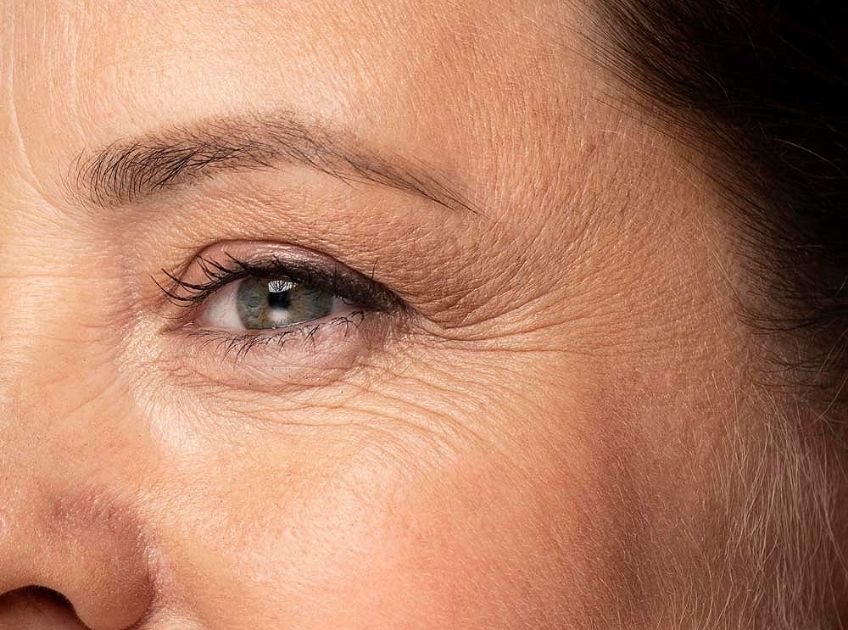 natural oils for wrinkles