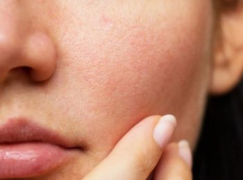 how to close open pores on face