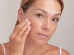 how to heal sun damaged skin