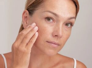 how to heal sun damaged skin