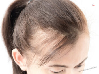 how to regrow hair on a bald spot