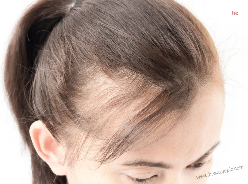 how to regrow hair on a bald spot